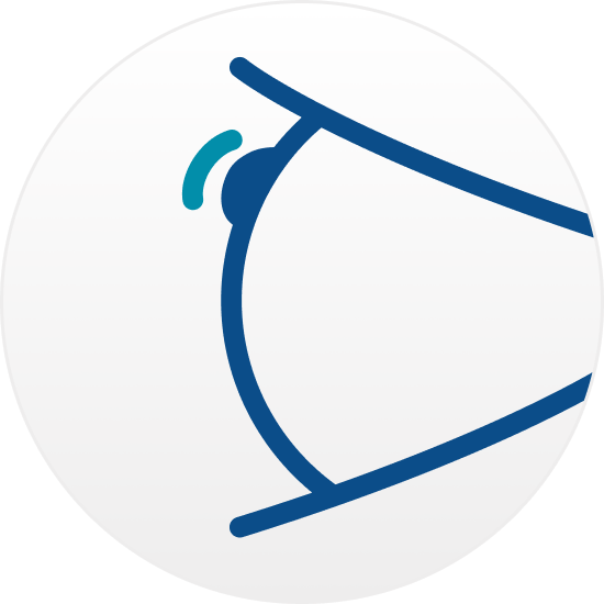 Graphic of radioactive disk placed on the eye 