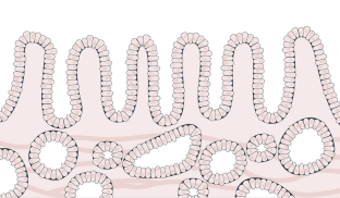 Tall, slender cells are slightly irregular in shape and organization