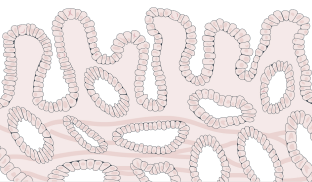 Tall, slender cells are irregular in shape and organization