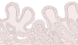 Tall, slender cells are densely clustered together and disorganized