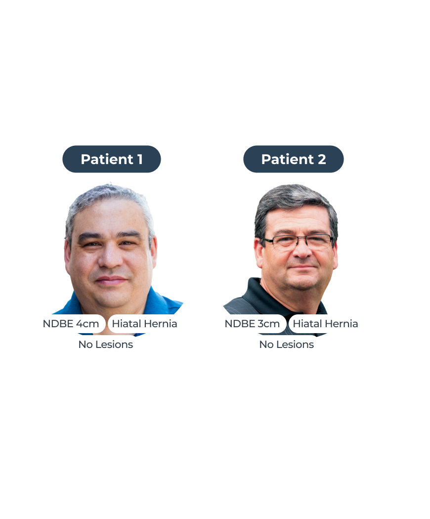 Two older men share pathology and clinical features: non-dysplastic Barrett's Esophagus, hiatal hernia, and no lesions. 